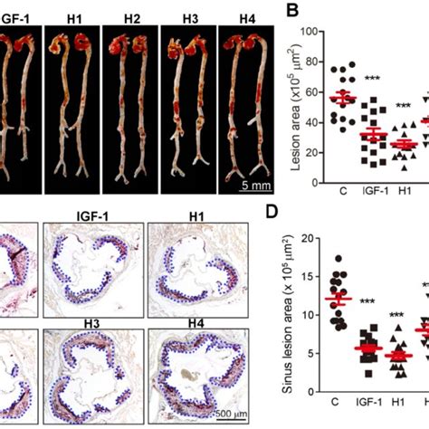 Analysis Of Atherosclerotic Lesions Area In En Face Aortas And Aortic