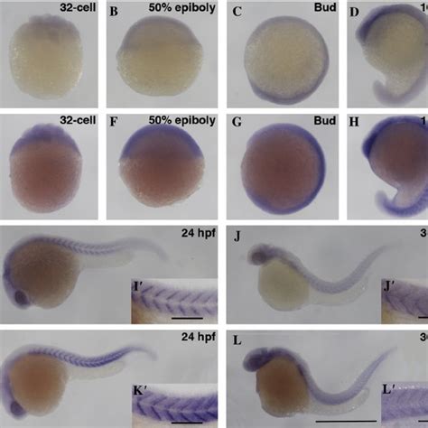 Expression Pattern Of Zebrafish Myo Aa And Myo Ab During Early