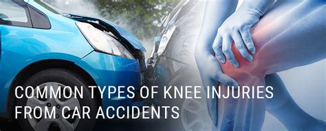 Common Types of Knee Injuries From Car Accidents