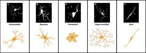 Frontiers Microglial Morphometric Analysis So Many Options So