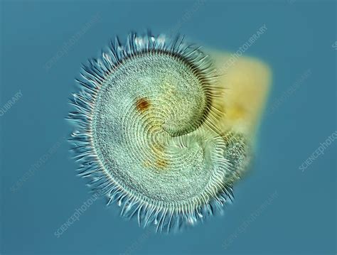 Stentor Protozoan Light Micrograph Stock Image C Science