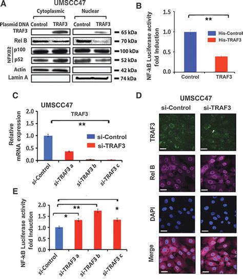 TRAF3 Decreases Nuclear NF KB P52 And RELB Localization And NF KB