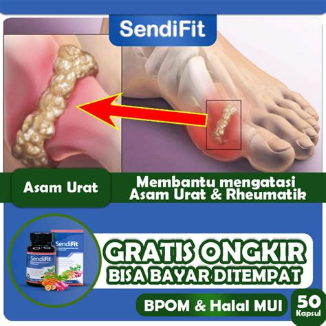 Obat Asam Urat Gout Patah Tulang Pseudogout Traumatic Synovitis