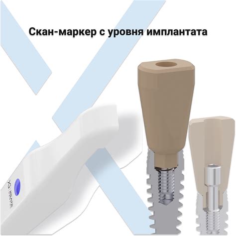 Скан-маркер с уровня имплантата - XGateDental
