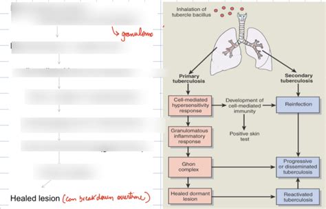 Tb Diagram Quizlet