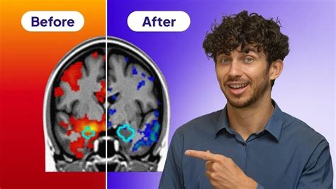 Evidence Based Techniques To Reduce Tinnitus Faster