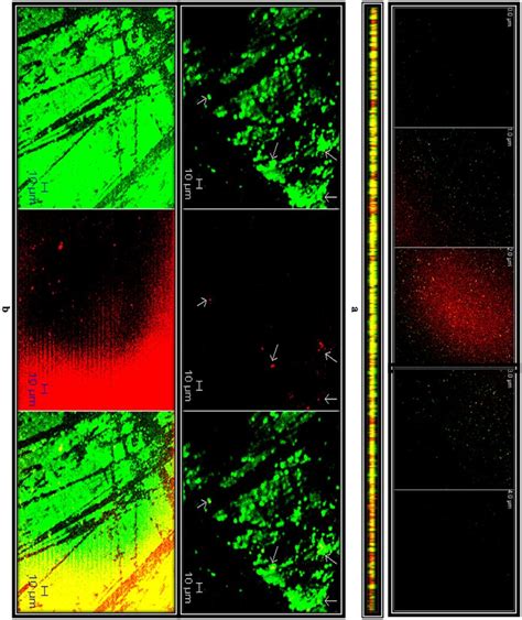 Clsm Projections Of Hold A Pallidus E Biofilms Grown In A