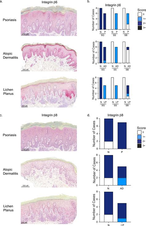 Tgf Activating Integrins And Are Dysregulated In Inflammatory