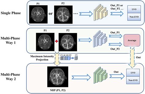 Frontiers Deep Learning Assisted Diagnosis Of Large Vessel Occlusion