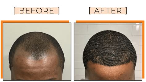 Chicago Il African American Hair Gallery Dr Yates Hair Science