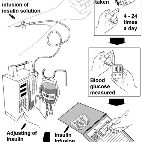 System Diagram Of The Automatic Insulin Infusion System Aiis For