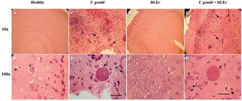 Scielo Brasil Histopathology Of Murine Toxoplasmosis Under