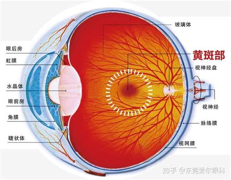 视物变形，视野中心有暗点，警惕“黄斑”出问题 知乎