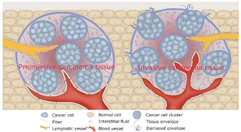 A Sketch For Cancer Cell Microenvironment Interface Preinvasive