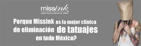 Missink Laser Tattoo Removal Clinic Cl Nica De Eliminaci N De Tatuajes