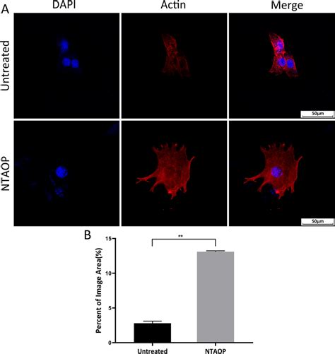 A Clsm Images Of Actin Cytoskeleton Of Mc T E Cells Scale Bar