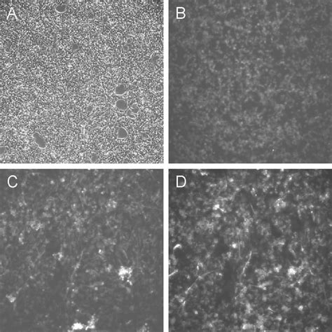 Photomicrographs Of Human Neural Stem Cells Sc30 Showing Brdu Nestin Download Scientific