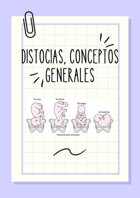 Distocia Conceptos Generales Luisana Aneth Cr Udocz