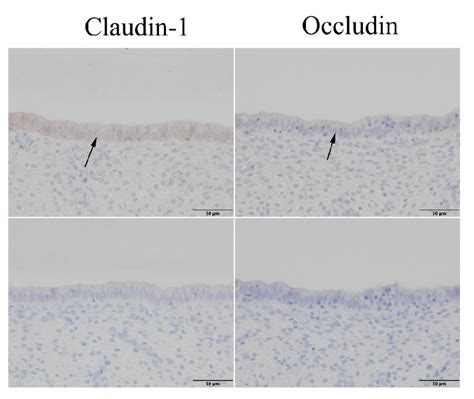 Immunohistochemical Staining Of Claudin 1 And Occludin In Sheep Uterine