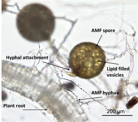 Mycorrhizae Microscope