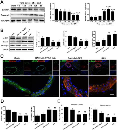 Ppar Mediated Cerebral Vsmc Phenotypic Switch And Vascular