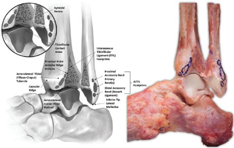 Anatomy Ankle Syndesmosis Distal Tibiofibular Joint Rayner Smale