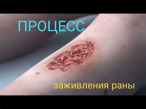 Как Происходит Процесс Заживления Раны Человека #микроскоп #микромир ...