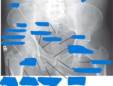 Pelvis Anatomy Radiograph Diagram Quizlet