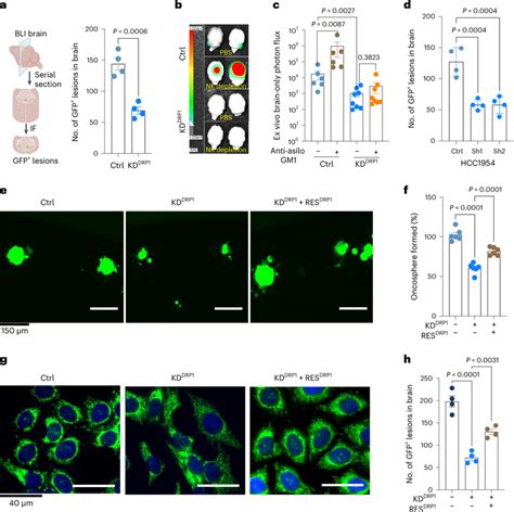 Drp Driven Mitochondrial Plasticity Promotes Metastatic Latency A