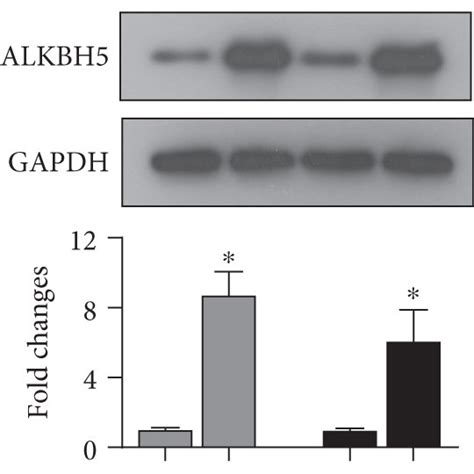 ALKBH5 Is Lowly Expressed In ESCC Tissues The MRNA A And Protein B