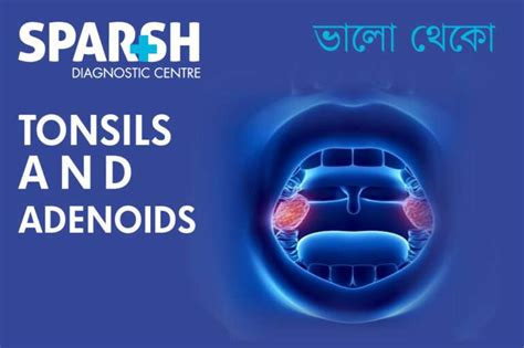 Tonsils And Adenoids Sparsh Diagnostic Center