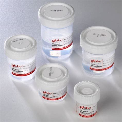 Tite Rite Containers Prefilled With Neutral Buffered Formalin Globe