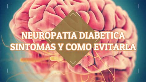 Neuropatia Diabetica S Ntomas Y Como Prevenirla Youtube