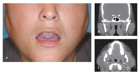 Random Swelling Of The Face