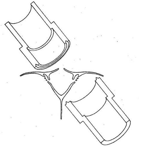 Experimental Arrangement Of Chamber Enclosing Arachnoid Villi Upper