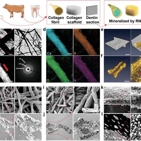 Characterization Of Collagen Fibrils Mineralized With Rnaacp