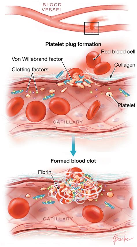 Protected World Hemophilia Day Operon Biotech Healthcare