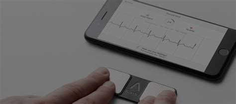 Smart Device ECG Monitoring - Bayside Heart