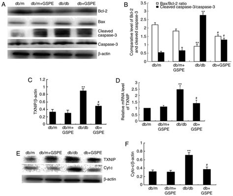 Anthocyanins Inhibit High Glucose Induced Renal Tubular Cell Apoptosis