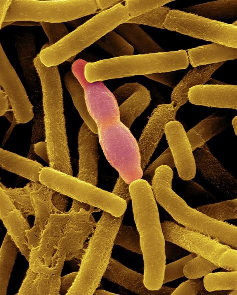 Bacillus Anthracis 23 Photograph By Science Photo Library Pixels