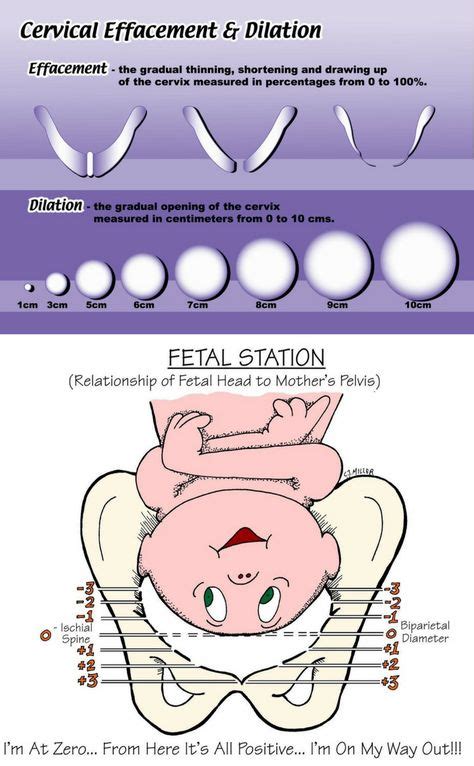 21 Best Cervical dilation chart ideas in 2021 | dilations, cervical ...