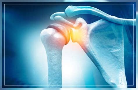 Frozen Shoulder Symptoms Causes Diagnosis And Treatment Repc