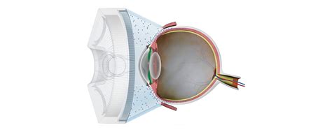 SEAGULL Technologies | SonoEye — Design Momentum