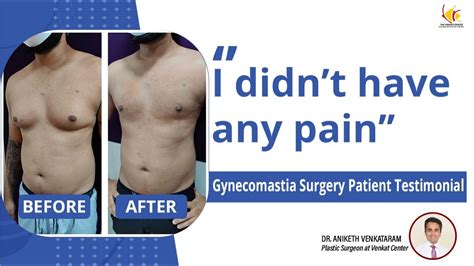 Gynecomastia Surgery Experience Man Boobs Reduction Surgery Venkat Center Youtube