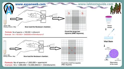 AST Test Procedure Principle Reasults And More Lab Tests Guide