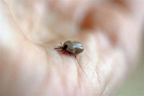 Vorsicht Zecken Borreliose Erkrankungen Gestiegen Apotheken Echo