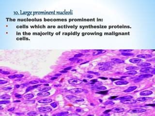 Epithelial dysplasia | PPT