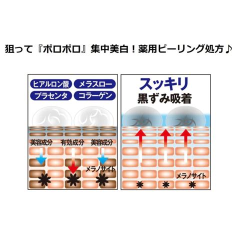 3個セット 薬用美白ピーリング シミーポロン 30g シミ対策 薬用美白クリーム 肌荒れ対策 しみ取りクリーム 日焼け対策 Hk0037