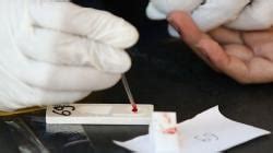 Pria Pesta Gay Di Puncak Bogor Dinkes Temukan Ada Yang Reaktif Hiv