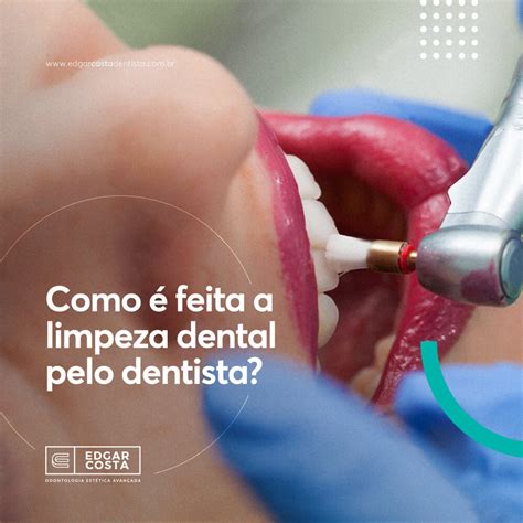 Blog Edgar Costa Odontologia Est Tica Avan Ada